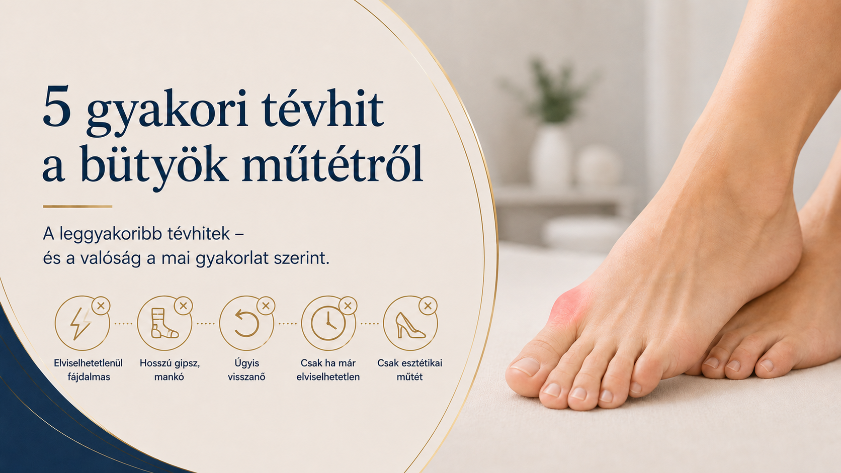 5 gyakori tévhit a bütyök műtétről
