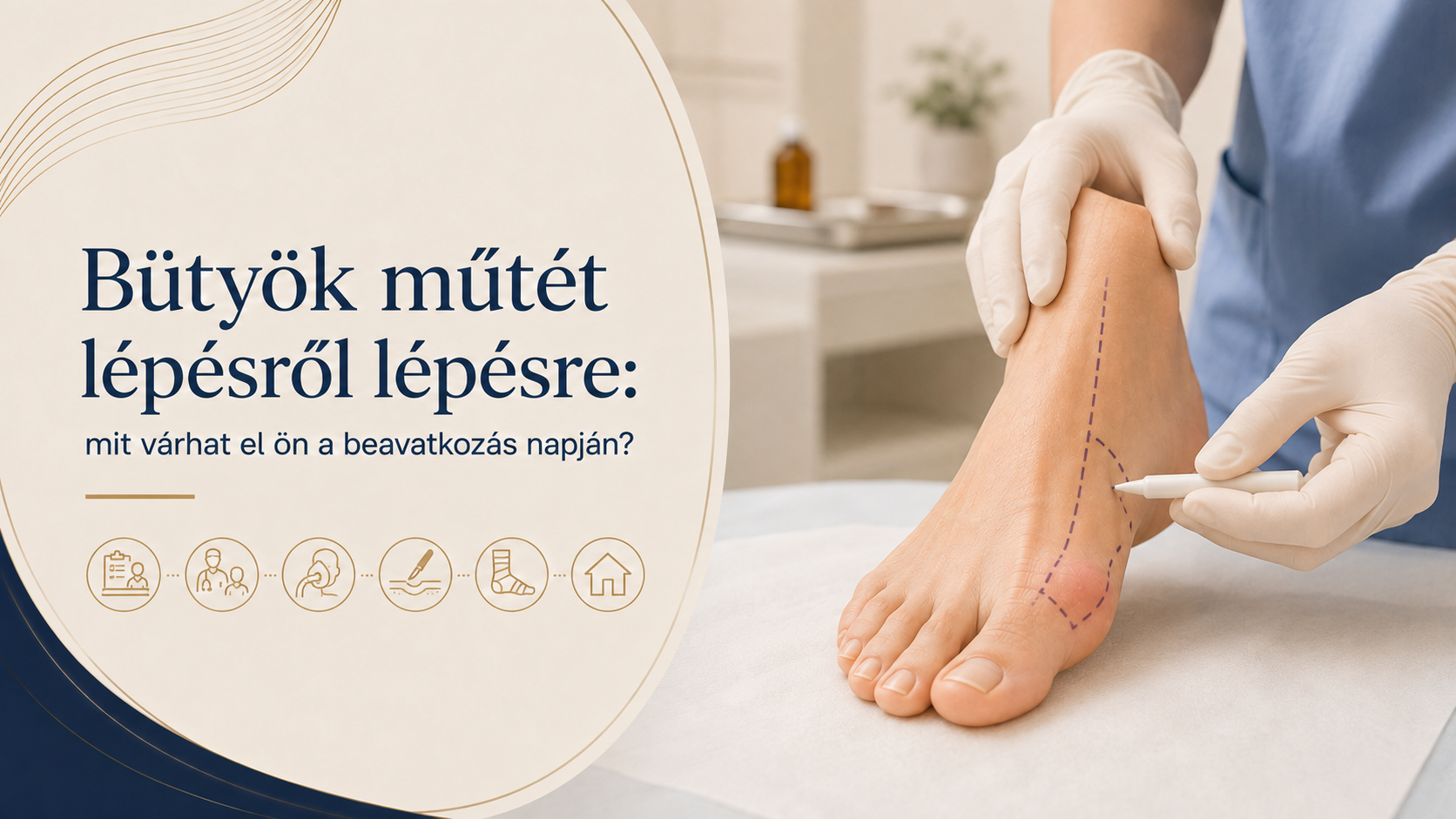 Bütyök műtét lépésről lépésre: mit várhat el ön a beavatkozás napján?